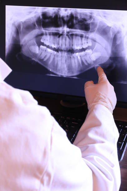 Best Emergency Tooth Extraction in Langley Park, MD